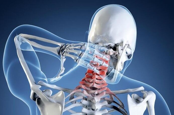 Osteochondroza de gradul 1